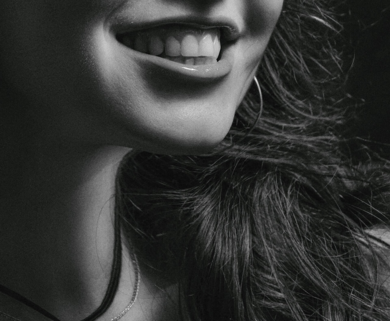Cosmetic Bonding at ELEV8 Biological Dentistry, Beverly Hills