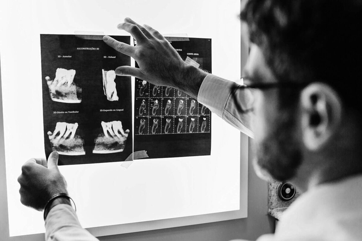 ELEV8 doctor reviewing 3D CBCT reconstructions and dental X-rays during a comprehensive new patient exam in Beverly Hills