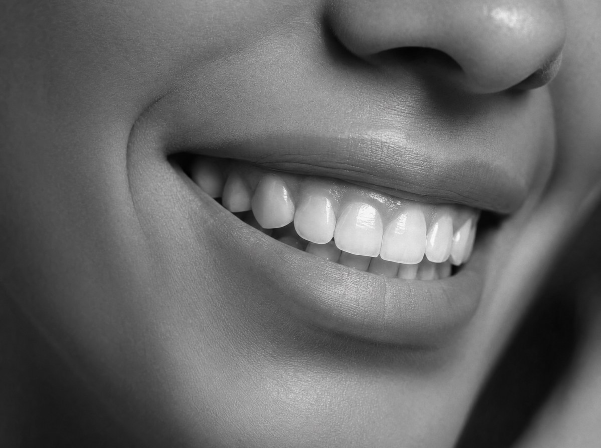 Gum Disease Treatment at ELEV8 Biological Dentistry, Beverly Hills