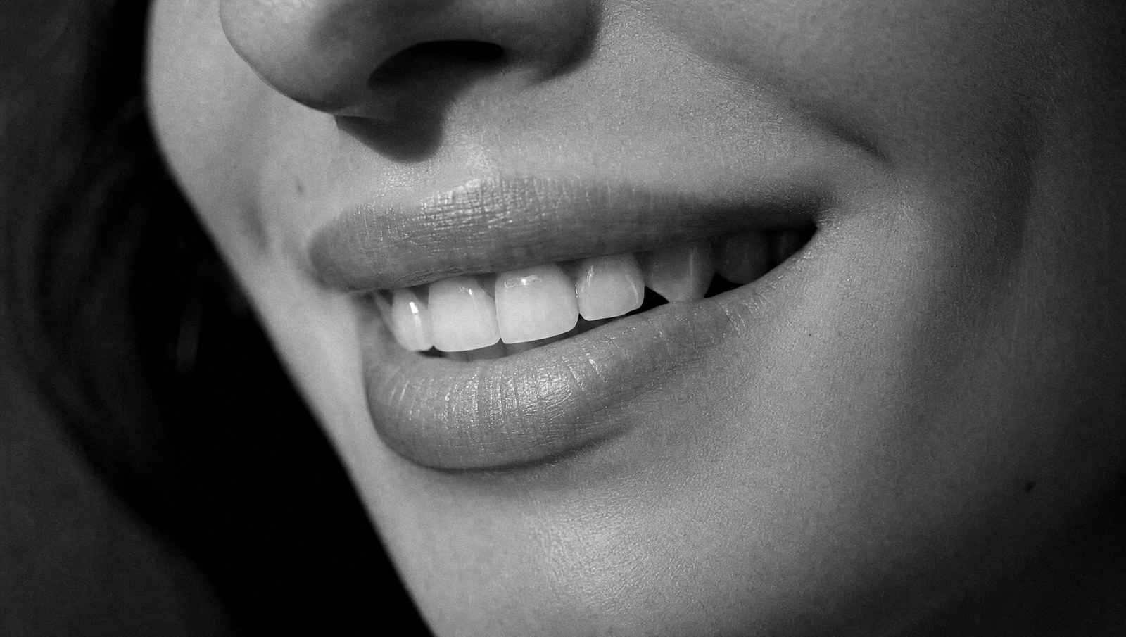 Teeth Whitening and Remineralization at ELEV8 Biological Dentistry, Beverly Hills